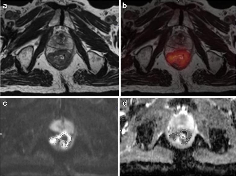 https://cdn.ncbi.nlm.nih.gov/pmc/blobs/d31d/4870464/fd6d06e55b00/13139_2015_390_Fig1_HTML.jpg