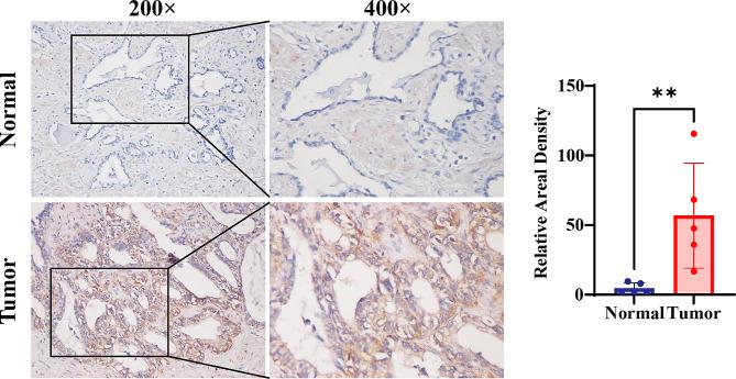 https://cdn.ncbi.nlm.nih.gov/pmc/blobs/d31f/10775669/6e0dd424c1ce/12885_2023_11778_Fig6_HTML.jpg