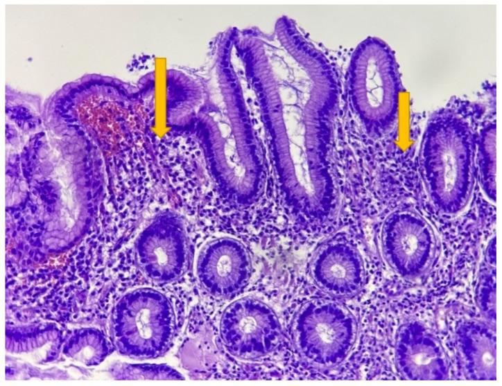 https://cdn.ncbi.nlm.nih.gov/pmc/blobs/d322/9783750/a5721aa30748/life-12-02096-g001.jpg