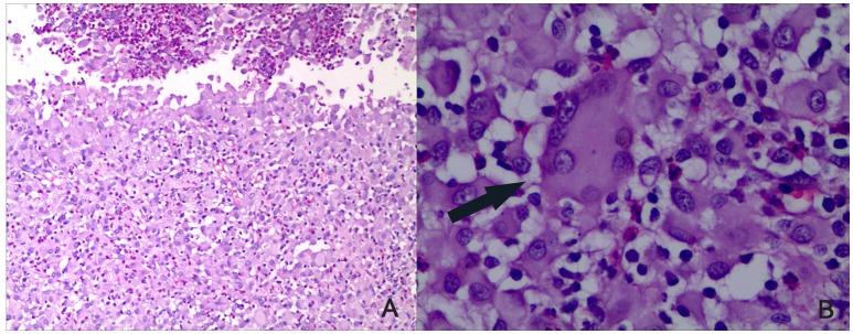 https://cdn.ncbi.nlm.nih.gov/pmc/blobs/d325/5434645/98c852459a3d/fmicb-08-00842-g0001.jpg
