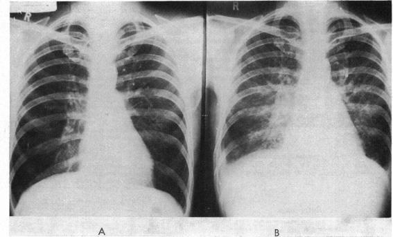 https://cdn.ncbi.nlm.nih.gov/pmc/blobs/d328/482833/3825c0217acc/brheartj00255-0082-a.jpg