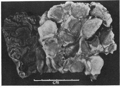 https://cdn.ncbi.nlm.nih.gov/pmc/blobs/d328/482833/bace6f006390/brheartj00255-0084-b.jpg