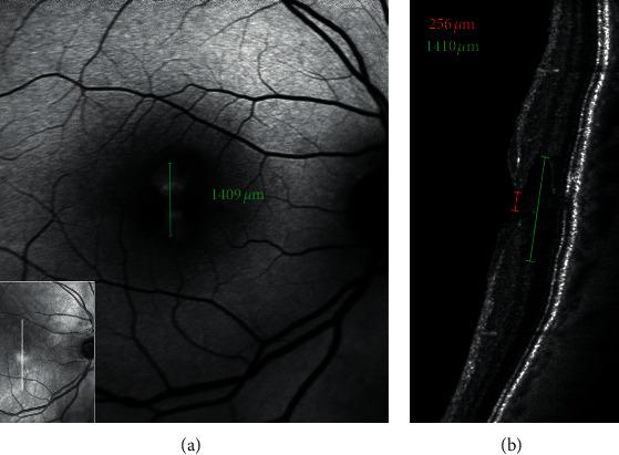 https://cdn.ncbi.nlm.nih.gov/pmc/blobs/d32b/7868145/94ab2cea3945/joph2021-8820444.009.jpg