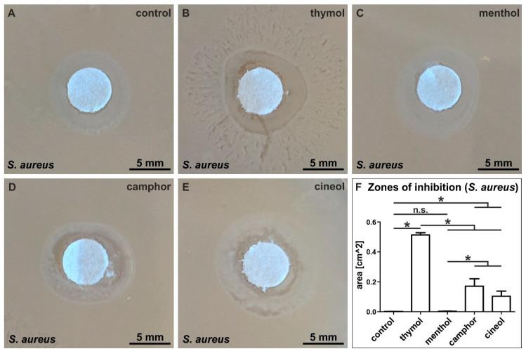 https://cdn.ncbi.nlm.nih.gov/pmc/blobs/d32c/7277086/cb699475920c/biomedicines-08-00105-g007.jpg