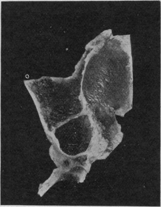 https://cdn.ncbi.nlm.nih.gov/pmc/blobs/d32d/1289237/c5de6892d934/janatphys00028-0058-b.jpg