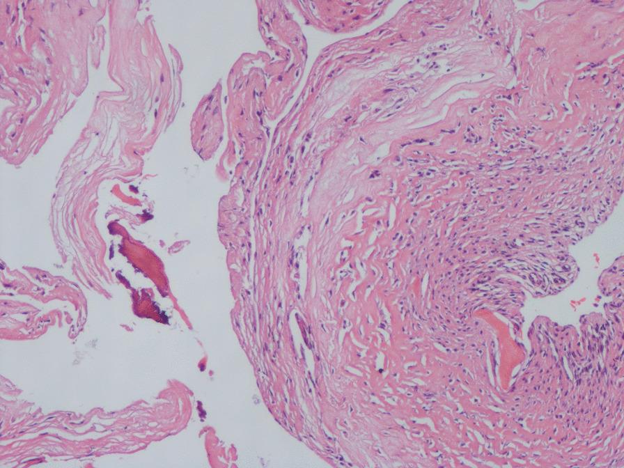 https://cdn.ncbi.nlm.nih.gov/pmc/blobs/d339/9554967/cdd3cfa34b94/13018_2022_3344_Fig9_HTML.jpg