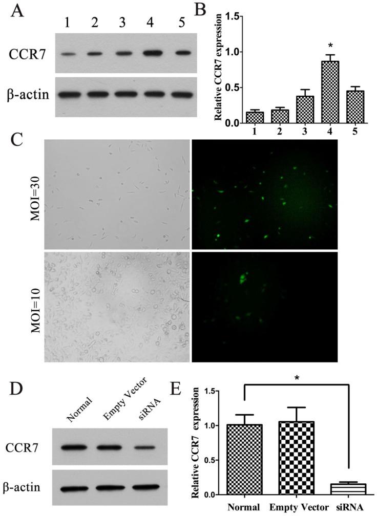 https://cdn.ncbi.nlm.nih.gov/pmc/blobs/d33a/5559968/6f8533b56a93/jcav08p2060g002.jpg