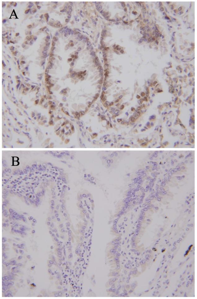 https://cdn.ncbi.nlm.nih.gov/pmc/blobs/d33a/5559968/f289b47968b9/jcav08p2060g001.jpg