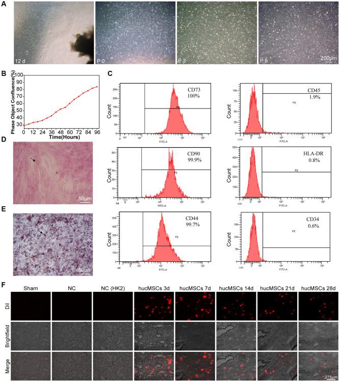 https://cdn.ncbi.nlm.nih.gov/pmc/blobs/d33e/10333056/206fa7418b78/aging-15-204805-g001.jpg