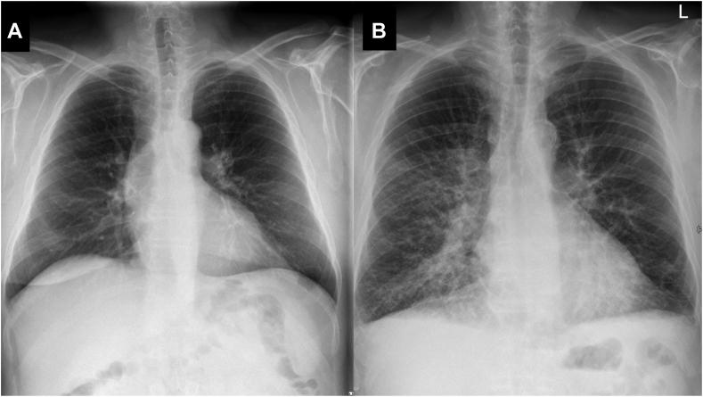 https://cdn.ncbi.nlm.nih.gov/pmc/blobs/d342/10774081/8f6e9ed6da3f/gr1.jpg