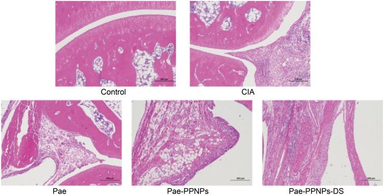https://cdn.ncbi.nlm.nih.gov/pmc/blobs/d342/12266063/bc868d5ed851/IJN-20-8967-g0015.jpg