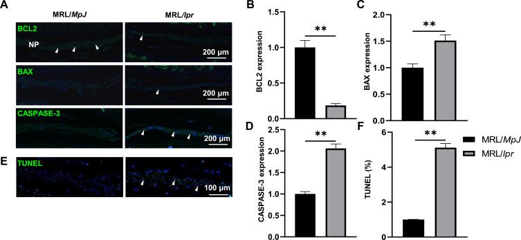 https://cdn.ncbi.nlm.nih.gov/pmc/blobs/d347/11520921/702db5bb1b2c/JIR-17-7705-g0003.jpg