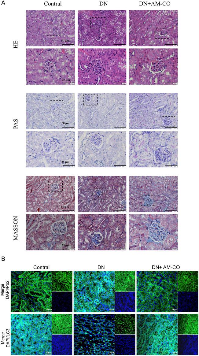 https://cdn.ncbi.nlm.nih.gov/pmc/blobs/d34d/12106390/8182df8a9325/fphar-16-1505637-g004.jpg