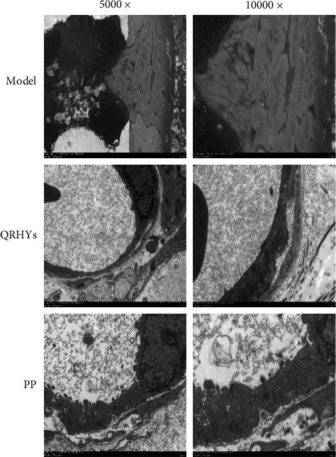 https://cdn.ncbi.nlm.nih.gov/pmc/blobs/d34f/9042638/00d2012e676c/CMMM2022-9397478.004.jpg