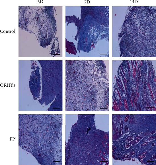 https://cdn.ncbi.nlm.nih.gov/pmc/blobs/d34f/9042638/72cd62d7f799/CMMM2022-9397478.003.jpg