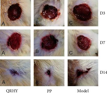 https://cdn.ncbi.nlm.nih.gov/pmc/blobs/d34f/9042638/ac0325ebf5d5/CMMM2022-9397478.001.jpg
