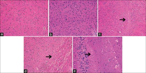 https://cdn.ncbi.nlm.nih.gov/pmc/blobs/d35d/5520558/976f5a8abe78/CMJ-130-1700-g006.jpg