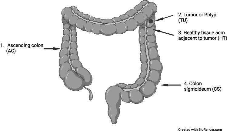 https://cdn.ncbi.nlm.nih.gov/pmc/blobs/d35e/9899194/188806478238/10096_2023_4551_Fig1_HTML.jpg