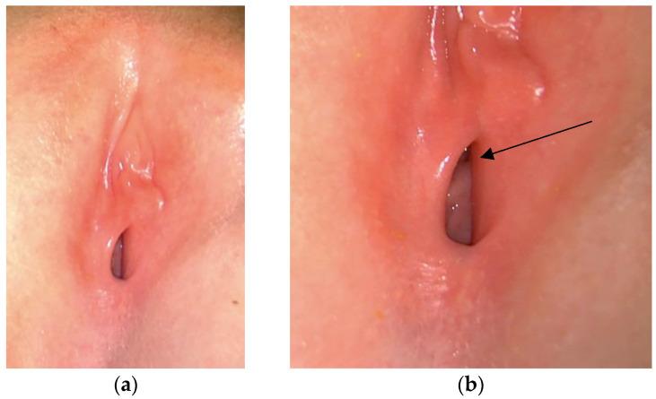 https://cdn.ncbi.nlm.nih.gov/pmc/blobs/d364/11270338/64106c881f1a/pediatrrep-16-00047-g003.jpg