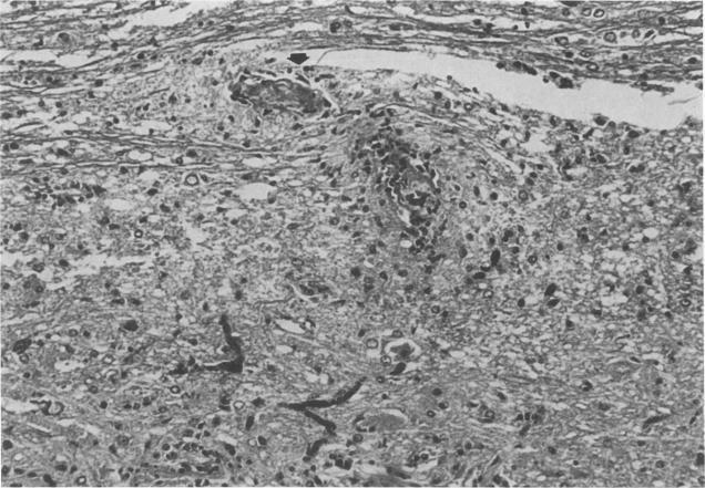 https://cdn.ncbi.nlm.nih.gov/pmc/blobs/d364/1916005/0570c6392193/amjpathol00206-0019-a.jpg