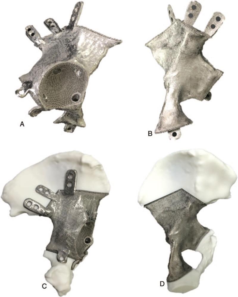 https://cdn.ncbi.nlm.nih.gov/pmc/blobs/d367/6738983/e15852318ba3/medi-98-e16658-g003.jpg