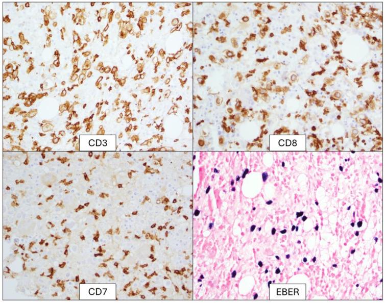 https://cdn.ncbi.nlm.nih.gov/pmc/blobs/d36c/12027426/8ce638606f48/genes-16-00382-g002.jpg