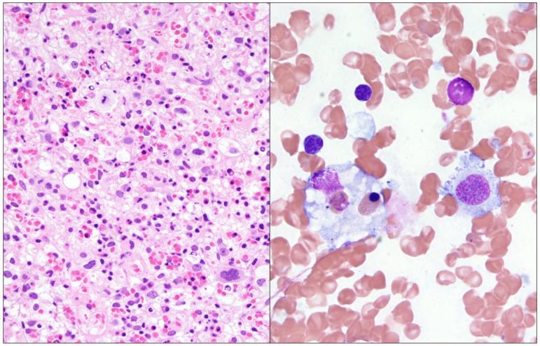 https://cdn.ncbi.nlm.nih.gov/pmc/blobs/d36c/12027426/bfa0f2b474bd/genes-16-00382-g001.jpg