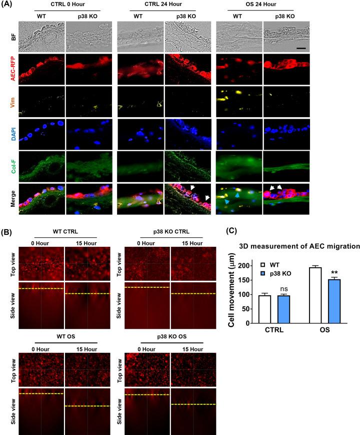 https://cdn.ncbi.nlm.nih.gov/pmc/blobs/d36f/9664350/7a82bdad5954/cs-136-cs20220491-g6.jpg
