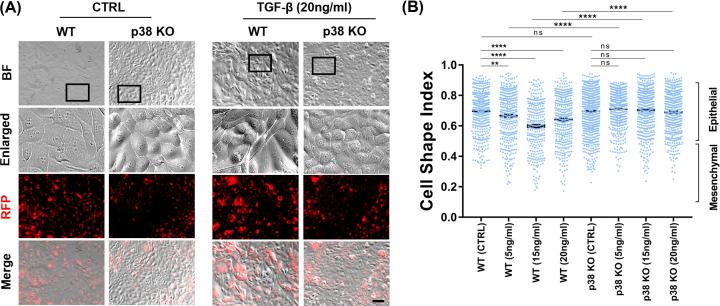 https://cdn.ncbi.nlm.nih.gov/pmc/blobs/d36f/9664350/ae1a9803d7f0/cs-136-cs20220491-g7.jpg