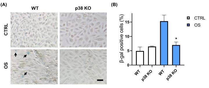 https://cdn.ncbi.nlm.nih.gov/pmc/blobs/d36f/9664350/c8d7087cdbbd/cs-136-cs20220491-g4.jpg
