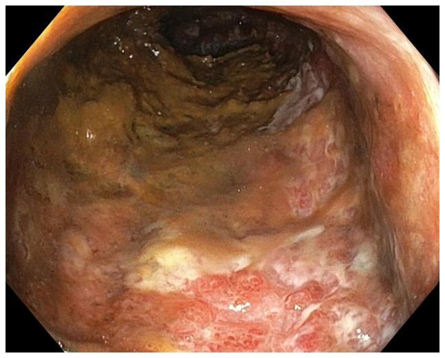 https://cdn.ncbi.nlm.nih.gov/pmc/blobs/d374/6580027/2321939f9b73/MMR-20-01-0787-g02.jpg