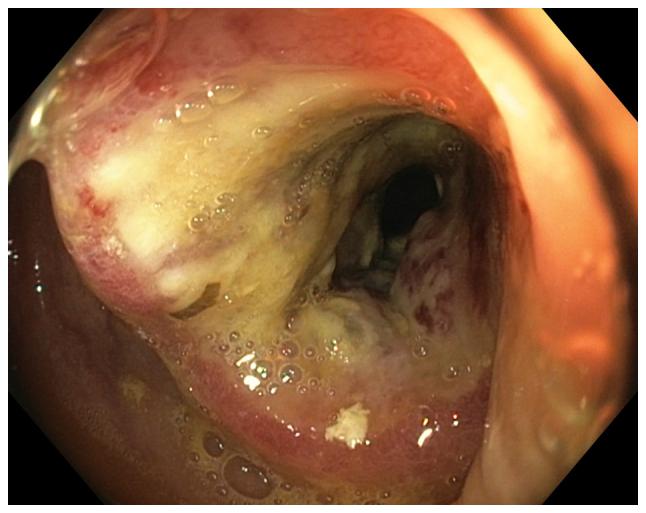 https://cdn.ncbi.nlm.nih.gov/pmc/blobs/d374/6580027/a717ed5b651b/MMR-20-01-0787-g03.jpg