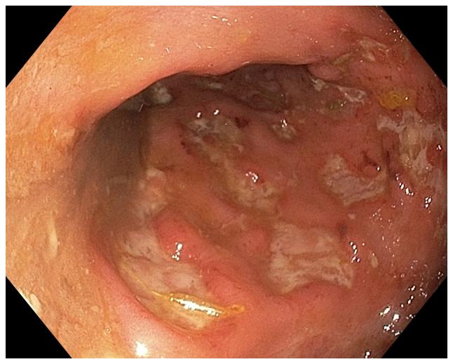 https://cdn.ncbi.nlm.nih.gov/pmc/blobs/d374/6580027/be7244aa776a/MMR-20-01-0787-g01.jpg