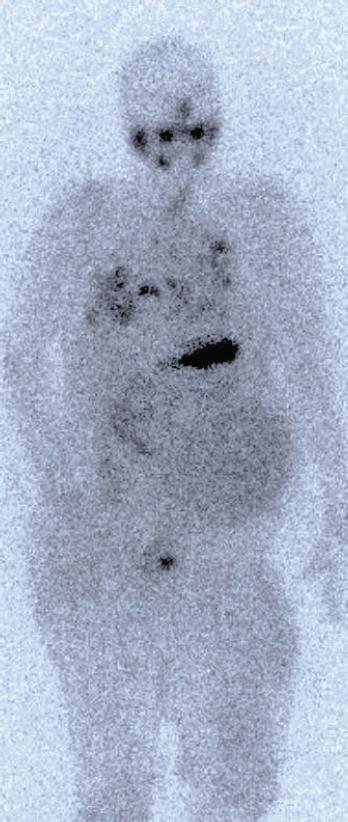 https://cdn.ncbi.nlm.nih.gov/pmc/blobs/d375/5303799/97377987a6c4/SaudiMedJ-37-1220-g003.jpg