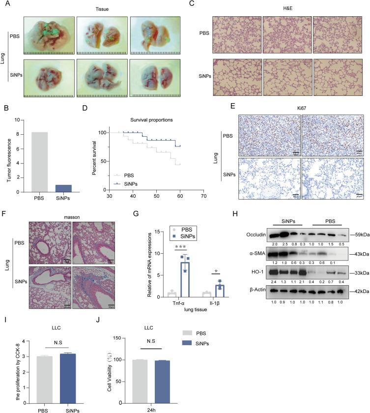 https://cdn.ncbi.nlm.nih.gov/pmc/blobs/d37c/11537155/01cd470f78ba/IJN-19-11087-g0004.jpg