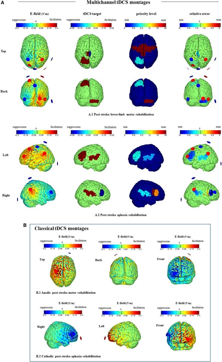 https://cdn.ncbi.nlm.nih.gov/pmc/blobs/d383/4764713/f49d54d9fc25/fneur-07-00021-g001.jpg