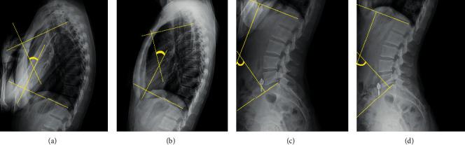 https://cdn.ncbi.nlm.nih.gov/pmc/blobs/d391/7707944/2790bd2ea0a5/ECAM2020-6526935.003.jpg