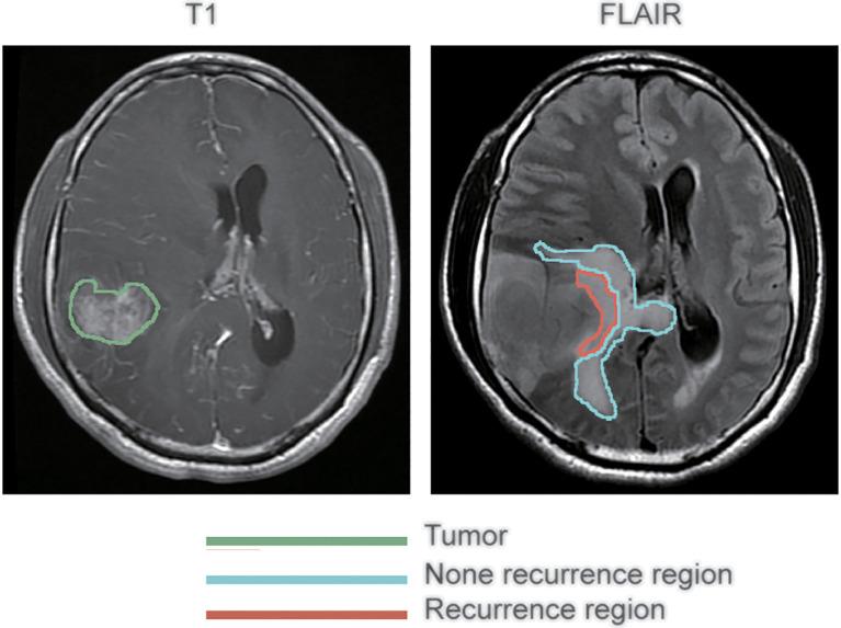 https://cdn.ncbi.nlm.nih.gov/pmc/blobs/d393/9845721/50e12c4c4ae3/fonc-12-1042498-g001.jpg