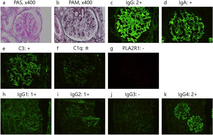 https://cdn.ncbi.nlm.nih.gov/pmc/blobs/d395/10982251/33ca56325d09/13730_2023_805_Fig1_HTML.jpg