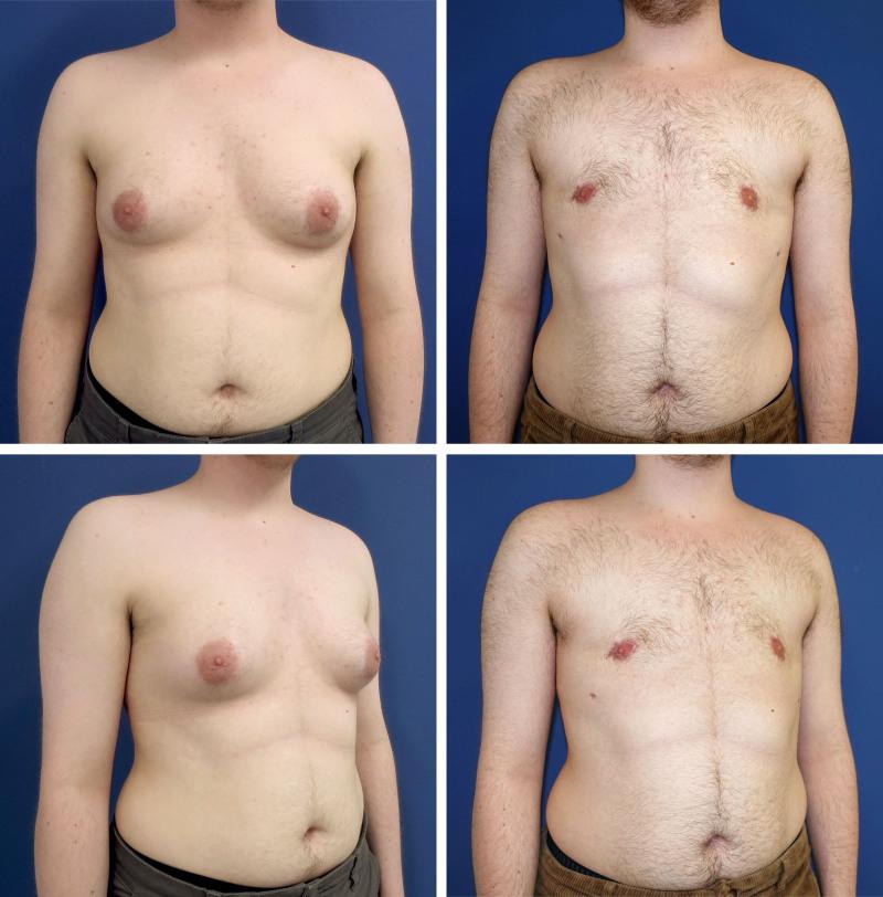 https://cdn.ncbi.nlm.nih.gov/pmc/blobs/d399/12188821/2fc9bbd24263/prs-156-11e-g008.jpg