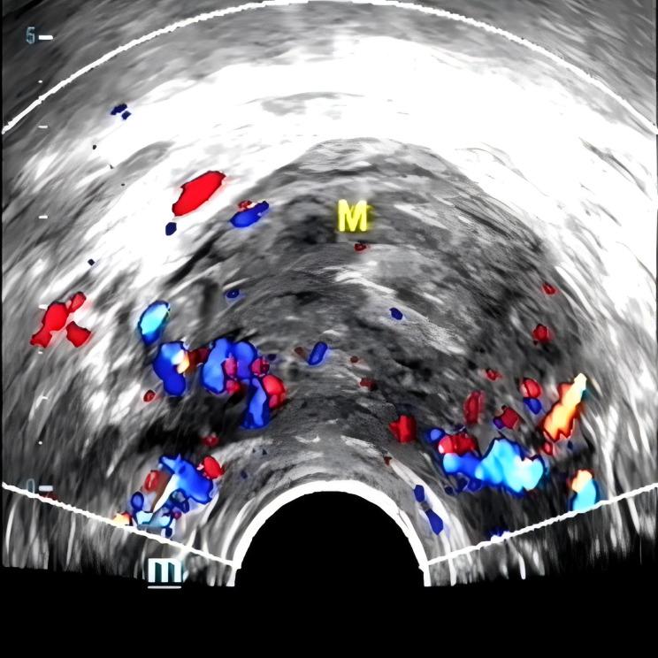 https://cdn.ncbi.nlm.nih.gov/pmc/blobs/d39d/12333630/acbaeebff9e7/IJWH-17-2401-g0005.jpg