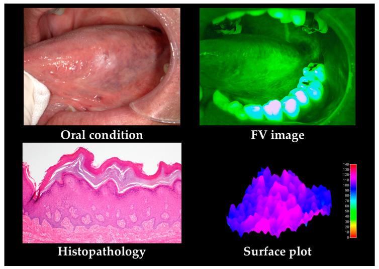https://cdn.ncbi.nlm.nih.gov/pmc/blobs/d39d/7601016/ac1b496833cd/cancers-12-02771-g003.jpg