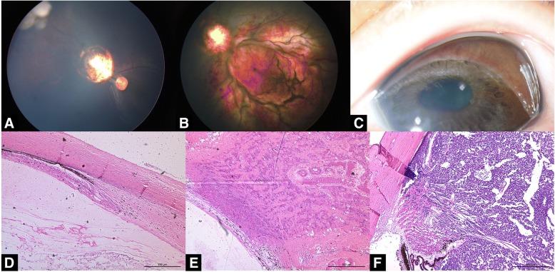 https://cdn.ncbi.nlm.nih.gov/pmc/blobs/d3ae/6390546/3e38c50a5ad6/12886_2019_1059_Fig4_HTML.jpg