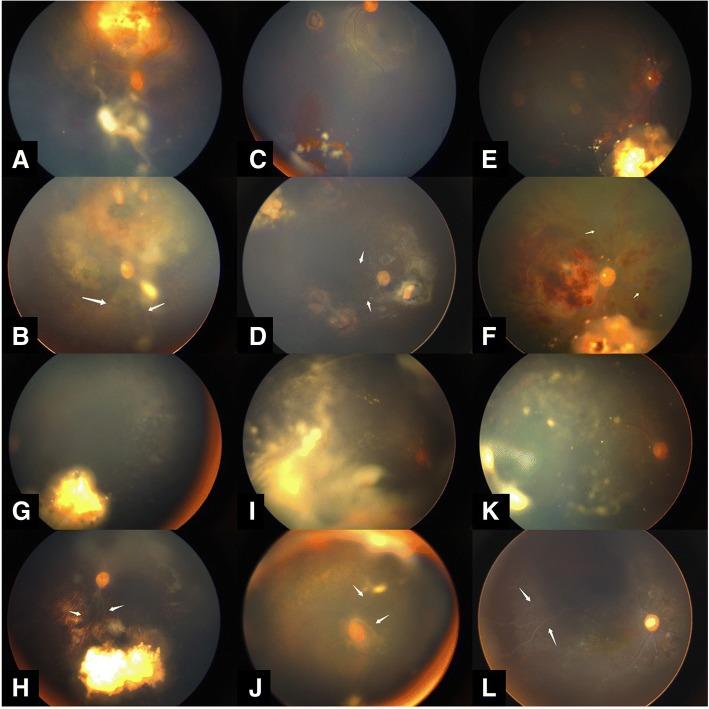 https://cdn.ncbi.nlm.nih.gov/pmc/blobs/d3ae/6390546/ec445f96a83a/12886_2019_1059_Fig5_HTML.jpg