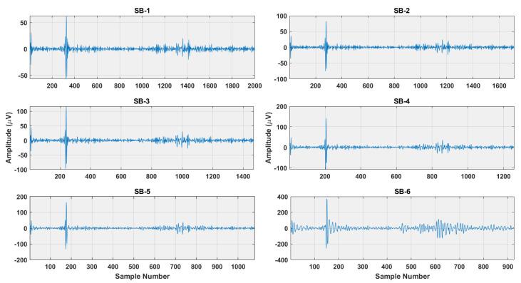 https://cdn.ncbi.nlm.nih.gov/pmc/blobs/d3b1/9657151/a8b1b2cfe21b/sensors-22-08128-g004.jpg