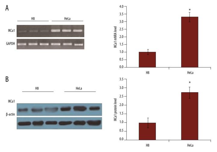 https://cdn.ncbi.nlm.nih.gov/pmc/blobs/d3b4/5358865/4d9b72e8fdb8/medscimonitbasicres-23-45-g003.jpg