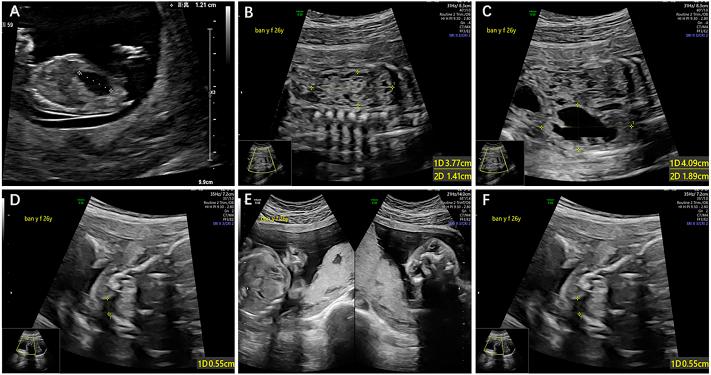 https://cdn.ncbi.nlm.nih.gov/pmc/blobs/d3b8/9662688/648b2cd708d5/fgene-13-1002089-g001.jpg