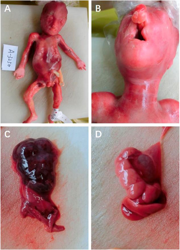 https://cdn.ncbi.nlm.nih.gov/pmc/blobs/d3b8/9662688/8e3d6ba00e3c/fgene-13-1002089-g002.jpg