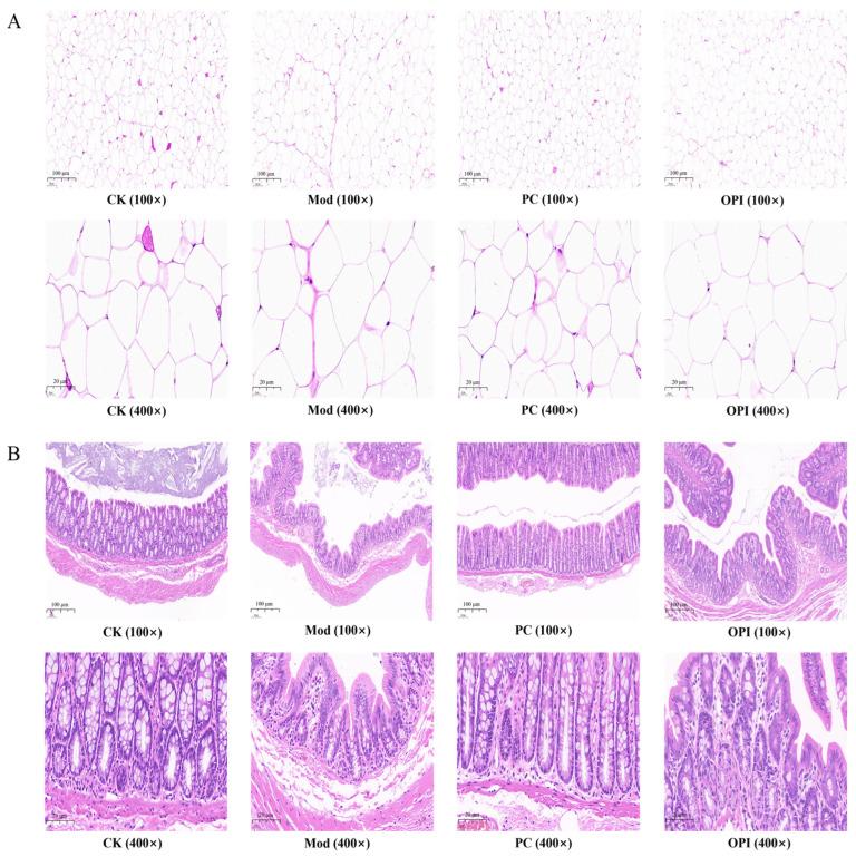 https://cdn.ncbi.nlm.nih.gov/pmc/blobs/d3b9/12192181/aba6f271e605/foods-14-02047-g003.jpg
