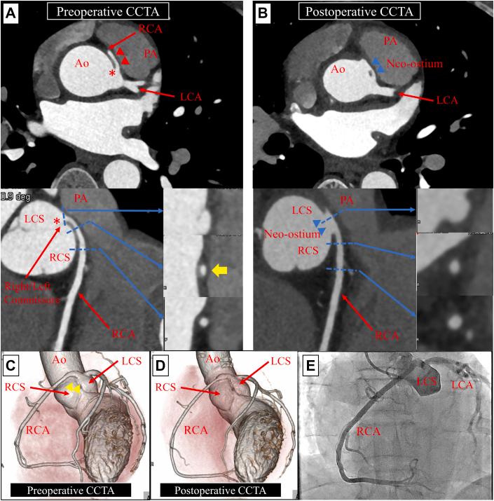 https://cdn.ncbi.nlm.nih.gov/pmc/blobs/d3c6/11708700/b77518bb6a01/gr1.jpg